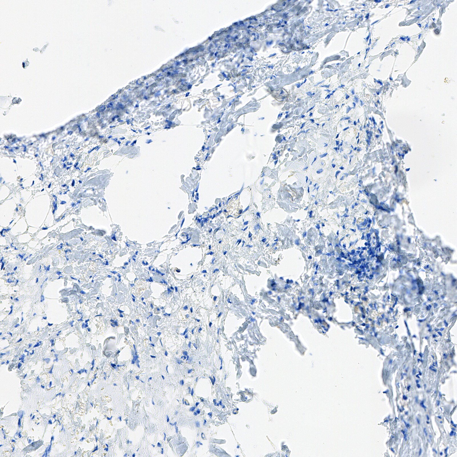 HER2 IHC 0 真实切片