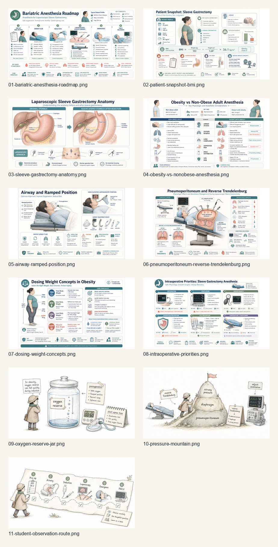Bariatric sleeve gastrectomy anesthesia figure overview