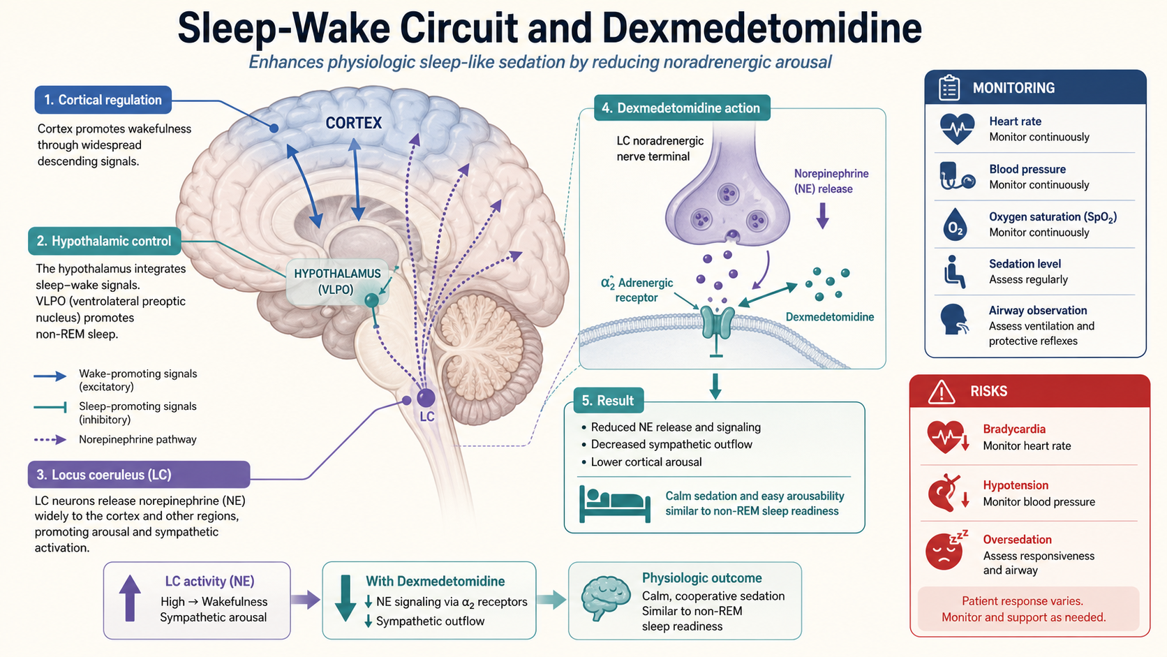 Dexmedetomidine and sleep-wake circuit