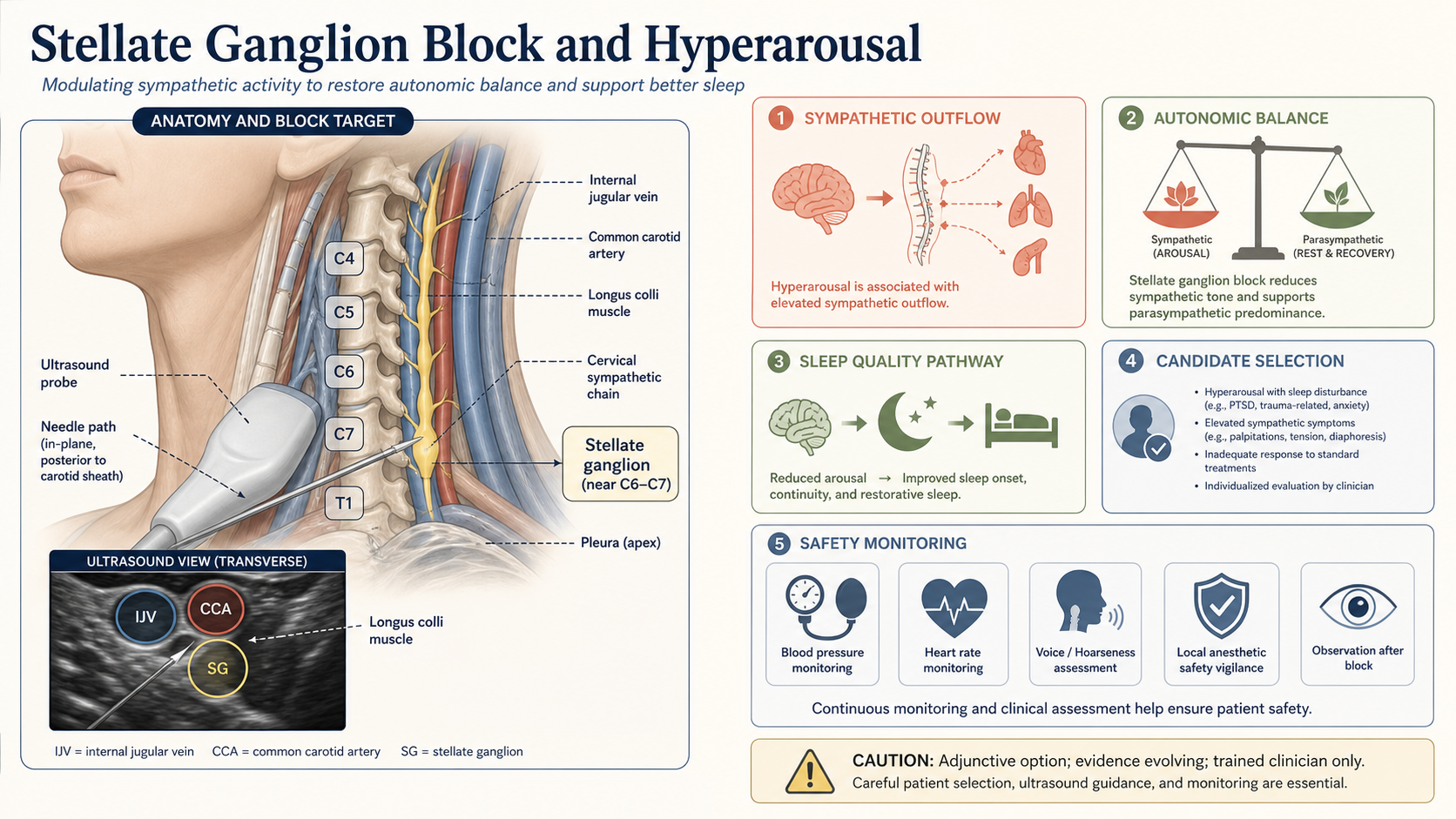 Stellate ganglion block and hyperarousal
